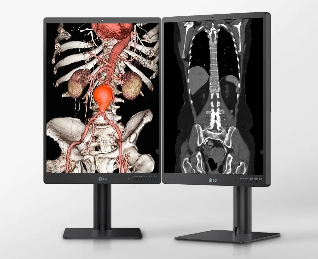 medical-diagnostic-21hq513d-01-1-lg-21-3-inch-3mp-ips-desktop