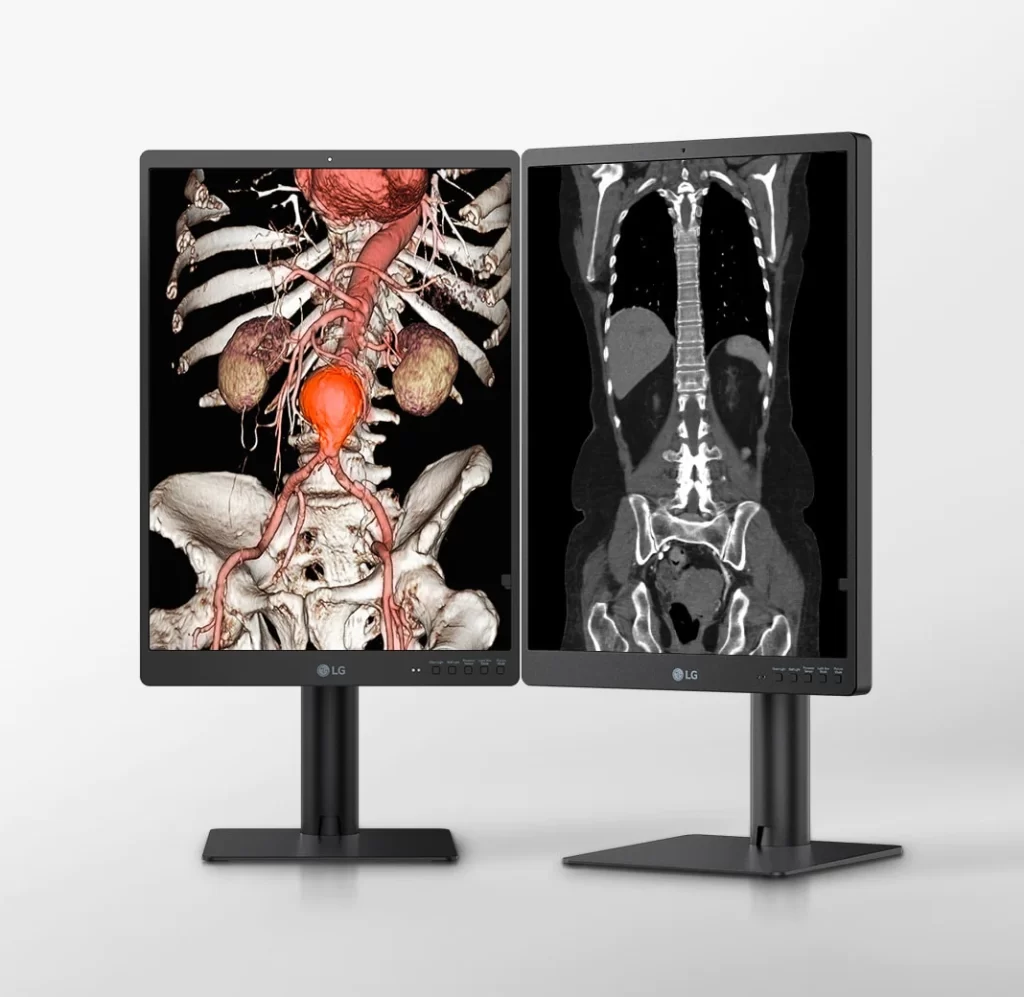 medical-diagnostic-21hq513d-01-1-lg-21-3-inch-3mp-ips-desktop-e1681594327461-1024x997